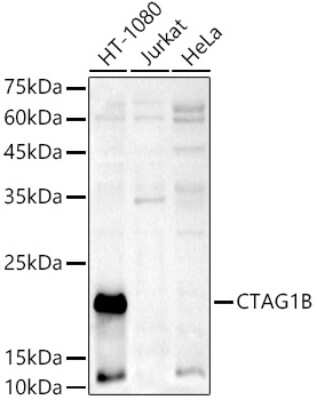 Western Blot: CTAG1B AntibodyAzide and BSA Free [NBP2-92840]